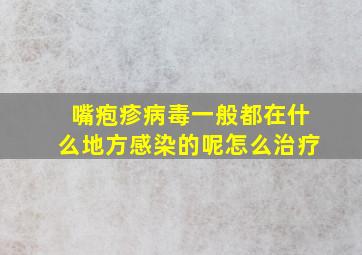 嘴疱疹病毒一般都在什么地方感染的呢怎么治疗