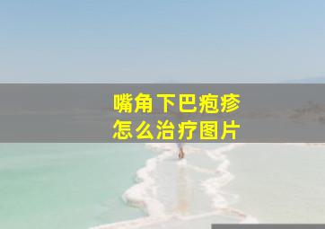 嘴角下巴疱疹怎么治疗图片