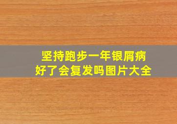 坚持跑步一年银屑病好了会复发吗图片大全