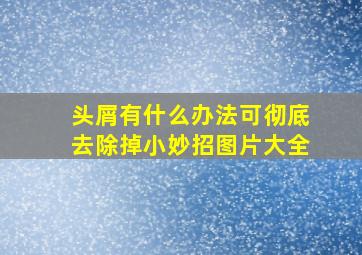 头屑有什么办法可彻底去除掉小妙招图片大全