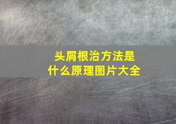 头屑根治方法是什么原理图片大全