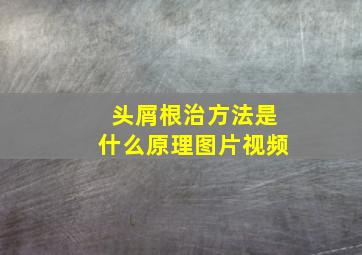 头屑根治方法是什么原理图片视频