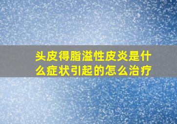 头皮得脂溢性皮炎是什么症状引起的怎么治疗