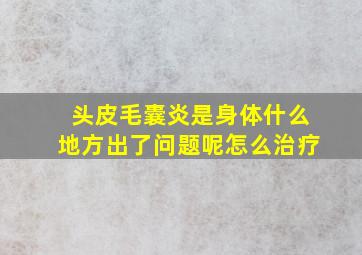 头皮毛囊炎是身体什么地方出了问题呢怎么治疗