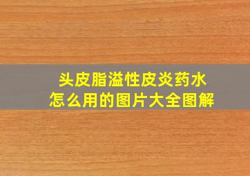 头皮脂溢性皮炎药水怎么用的图片大全图解