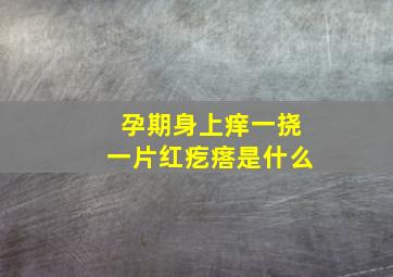 孕期身上痒一挠一片红疙瘩是什么