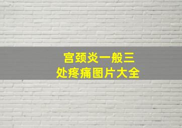 宫颈炎一般三处疼痛图片大全