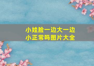 小娃脸一边大一边小正常吗图片大全