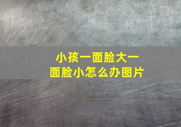 小孩一面脸大一面脸小怎么办图片