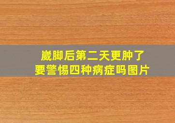 崴脚后第二天更肿了要警惕四种病症吗图片