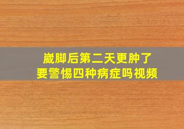 崴脚后第二天更肿了要警惕四种病症吗视频