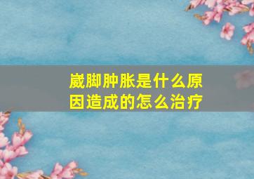 崴脚肿胀是什么原因造成的怎么治疗