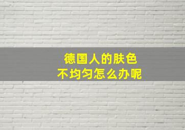 德国人的肤色不均匀怎么办呢