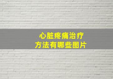 心脏疼痛治疗方法有哪些图片