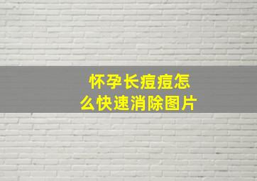 怀孕长痘痘怎么快速消除图片