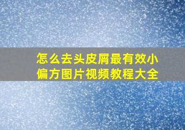 怎么去头皮屑最有效小偏方图片视频教程大全