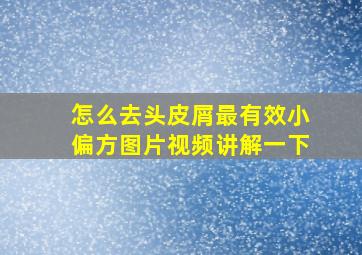 怎么去头皮屑最有效小偏方图片视频讲解一下