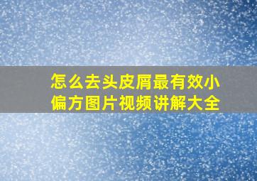 怎么去头皮屑最有效小偏方图片视频讲解大全