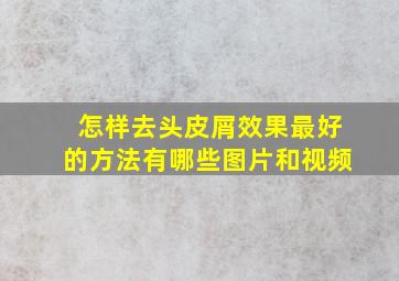 怎样去头皮屑效果最好的方法有哪些图片和视频