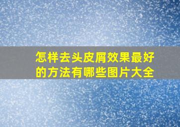 怎样去头皮屑效果最好的方法有哪些图片大全