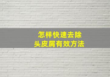 怎样快速去除头皮屑有效方法