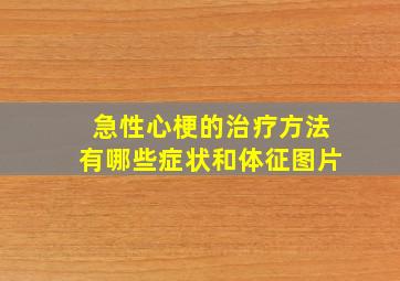 急性心梗的治疗方法有哪些症状和体征图片