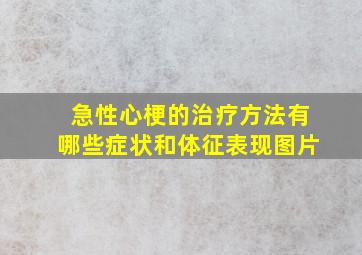 急性心梗的治疗方法有哪些症状和体征表现图片