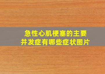 急性心肌梗塞的主要并发症有哪些症状图片