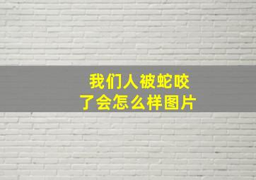 我们人被蛇咬了会怎么样图片