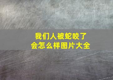 我们人被蛇咬了会怎么样图片大全