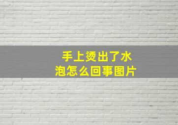 手上烫出了水泡怎么回事图片