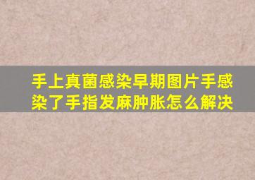 手上真菌感染早期图片手感染了手指发麻肿胀怎么解决