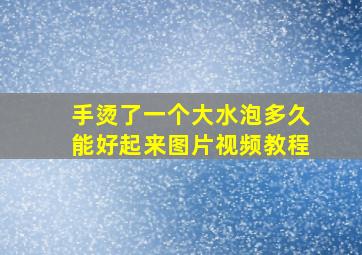 手烫了一个大水泡多久能好起来图片视频教程