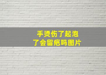 手烫伤了起泡了会留疤吗图片