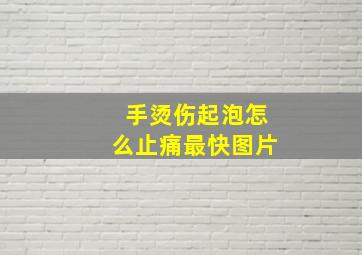 手烫伤起泡怎么止痛最快图片