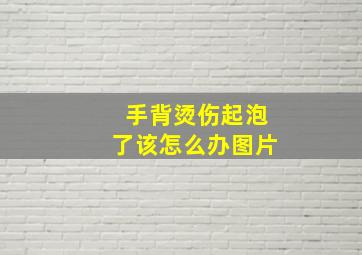 手背烫伤起泡了该怎么办图片