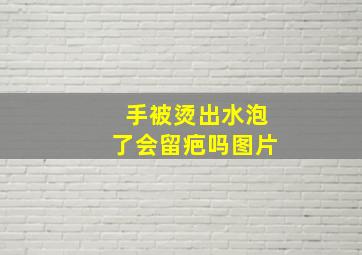 手被烫出水泡了会留疤吗图片