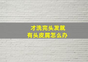 才洗完头发就有头皮屑怎么办