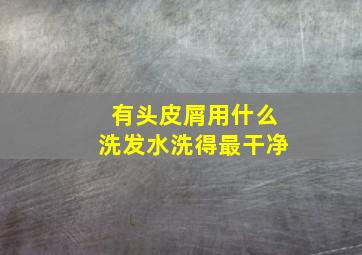 有头皮屑用什么洗发水洗得最干净