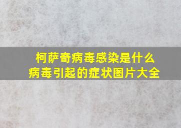 柯萨奇病毒感染是什么病毒引起的症状图片大全