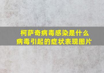 柯萨奇病毒感染是什么病毒引起的症状表现图片