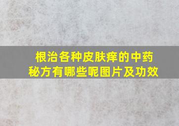 根治各种皮肤痒的中药秘方有哪些呢图片及功效