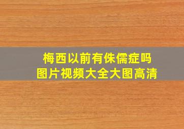 梅西以前有侏儒症吗图片视频大全大图高清