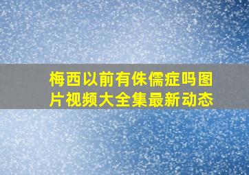 梅西以前有侏儒症吗图片视频大全集最新动态