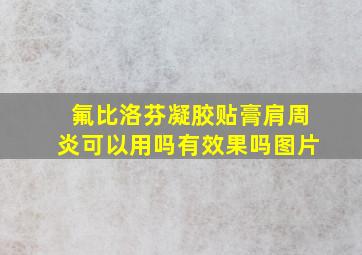 氟比洛芬凝胶贴膏肩周炎可以用吗有效果吗图片