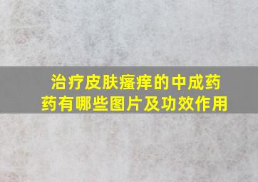 治疗皮肤瘙痒的中成药药有哪些图片及功效作用