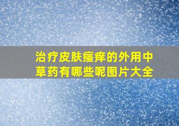 治疗皮肤瘙痒的外用中草药有哪些呢图片大全