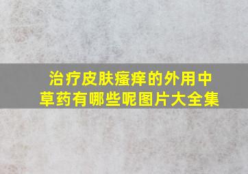 治疗皮肤瘙痒的外用中草药有哪些呢图片大全集