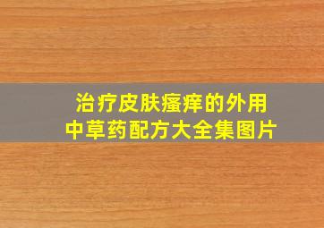 治疗皮肤瘙痒的外用中草药配方大全集图片