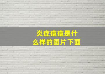 炎症痘痘是什么样的图片下面